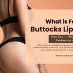 What is Female Buttocks Liposuction
