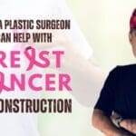 What Kind of Breast Reconstruction is Right for you after Breast Cancer?