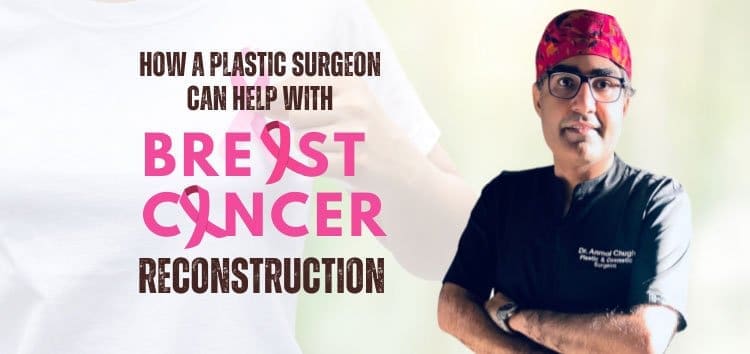 What Kind of Breast Reconstruction is Right for you after Breast Cancer?