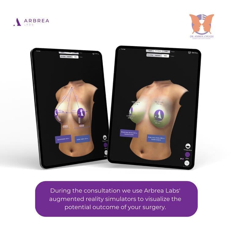 Breast Implants Consultation Step 2