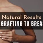 natural breast fat grafting