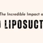 The Incredible Impact of 360-Degree Liposuction