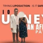Trying Liposuction - Is It Safe