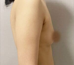 reason for small breasts 