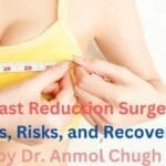 Breast Reduction Surgery Benefits, Risks, and Recovery Tips by Dr. Anmol Chugh