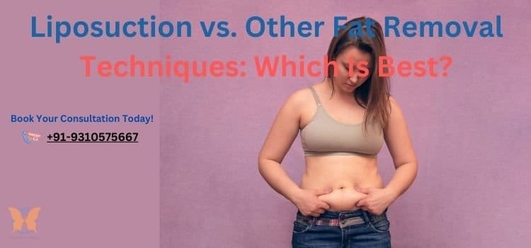 Liposuction vs. Other Fat Removal Techniques Which Is Best
