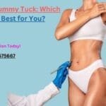 Comparison of liposuction and tummy tuck results for abdominal contouring and body shaping