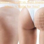 Brazilian Butt Lift vs. Butt Implants