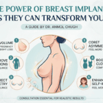 Dr. Anmol Chugh explaining how breast implants can transform confidence, body shape, and quality of life
