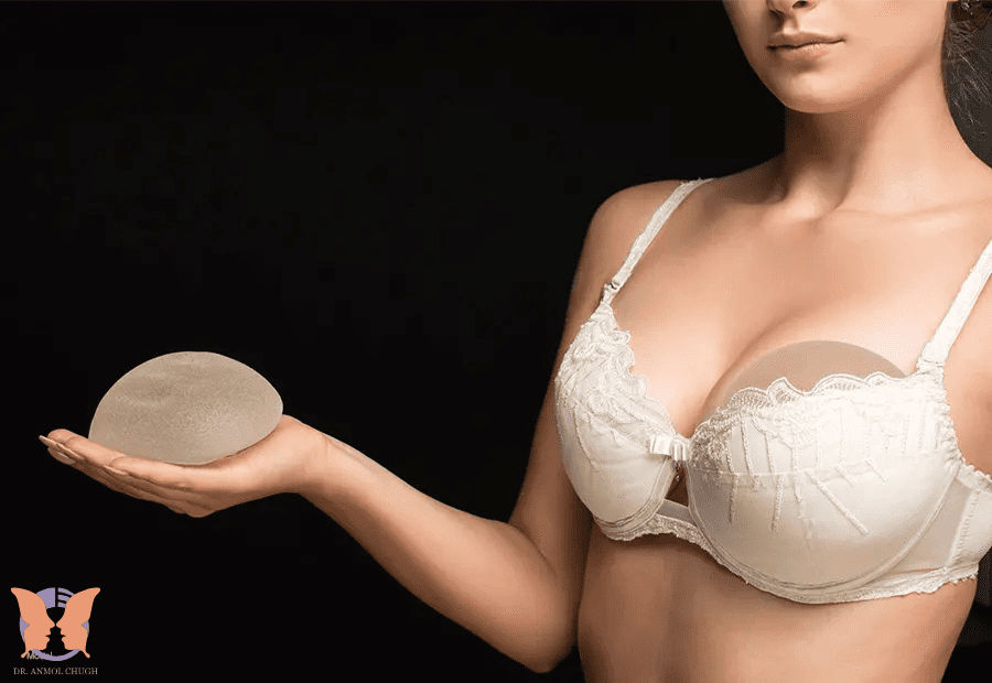 Breast Implants
