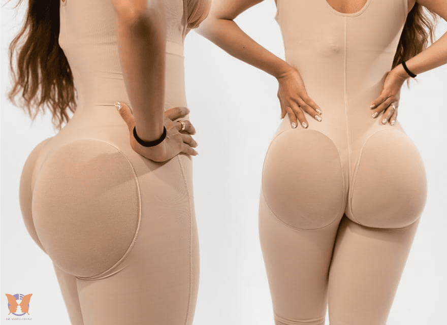 Tips for faster healing and achieving the best results after BBL surgery