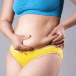 Understanding surgical options for apron belly and tummy tuck procedures