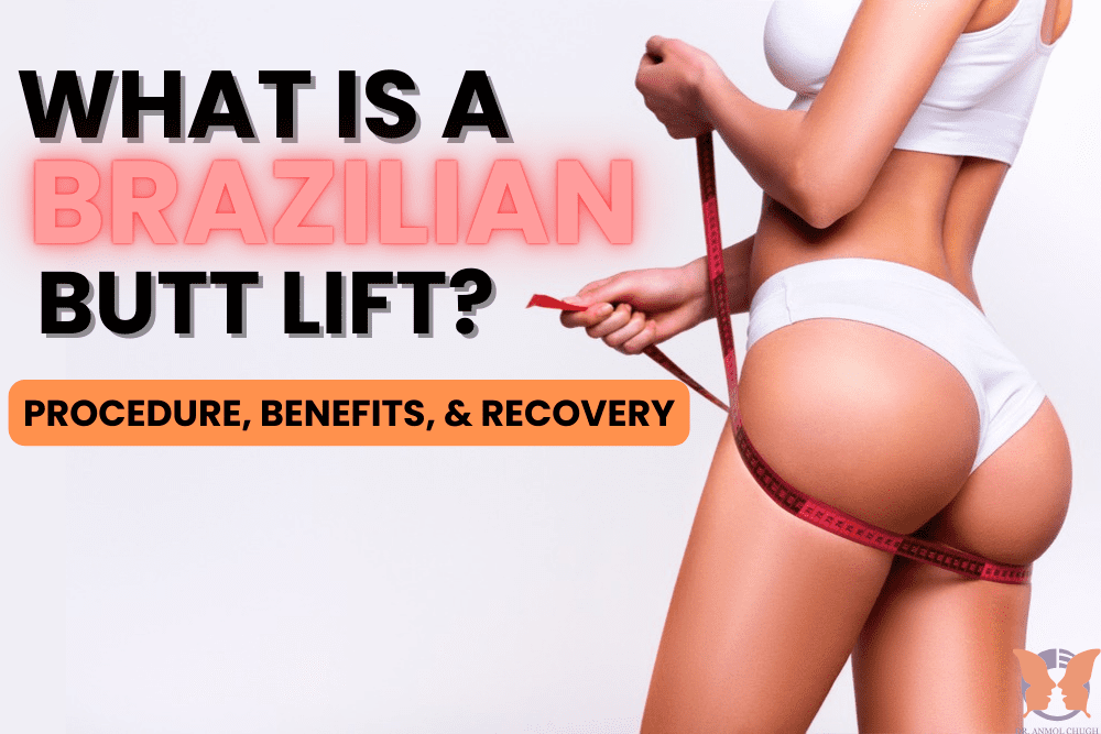 Brazilian Butt Lift results – Enhanced curves with natural fat transfer