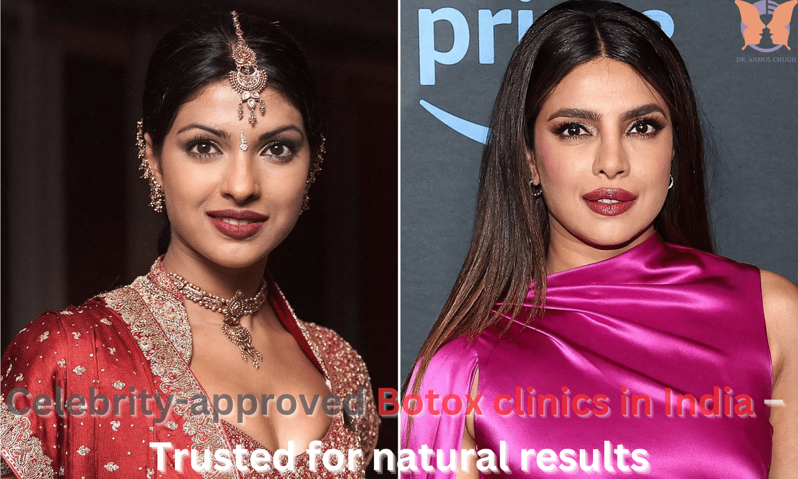 Celebrity-approved Botox clinics in India – Trusted for natural results