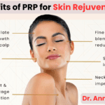 PRP therapy for skin rejuvenation – Improve skin texture and reduce wrinkles naturally