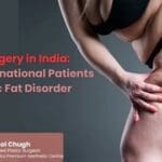 Lipedema Surgery in India – Specialized Care for International Patients with Chronic Fat Disorder