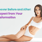 Mommy makeover before and after transformation – real patient results and recovery journey