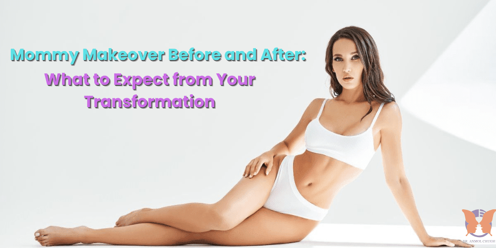 Mommy makeover before and after transformation – real patient results and recovery journey