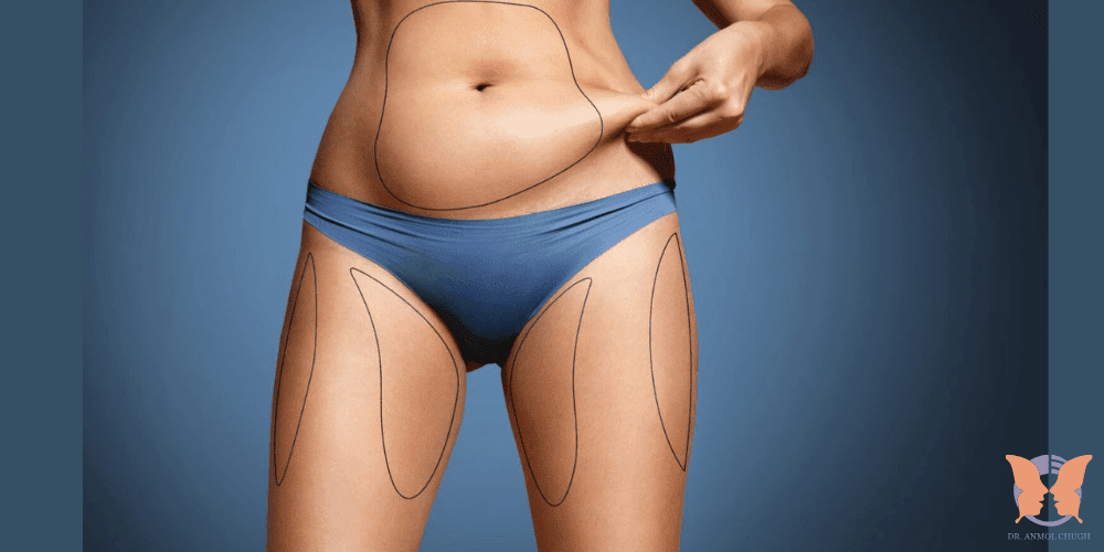 Understanding the pros and cons of liposuction – safe fat removal and body contouring options