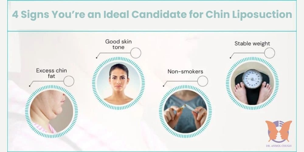 4 Signs You're an Ideal Candidate for Chin Liposuction