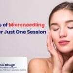 6 Skin Benefits of Microneedling You’ll See After Just One Session