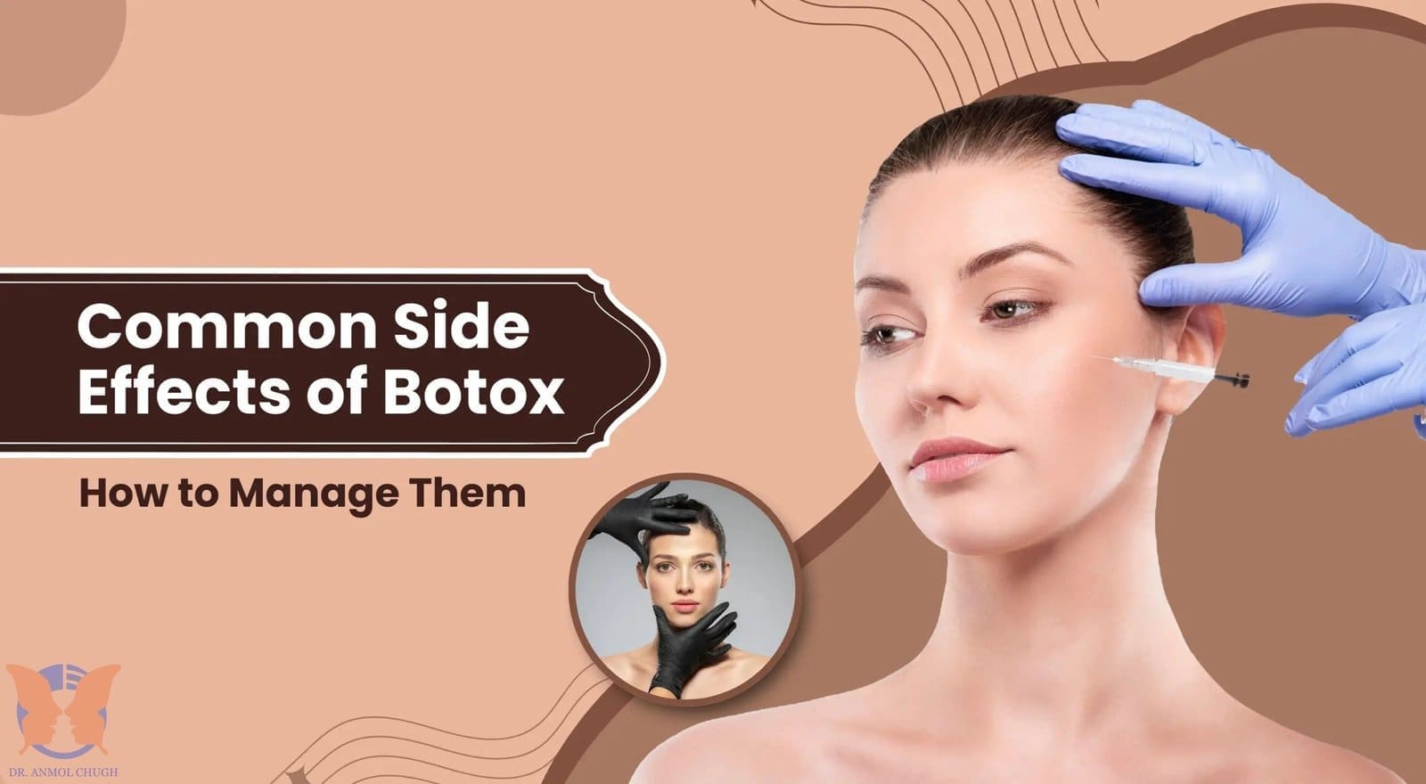Common side effects of Botox and fillers – swelling and bruising after treatment