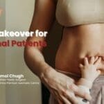 Mommy Makeover for International Patients