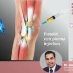 PRP for Sports Injuries: Why Athletes Swear by It