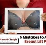 Post breast lift care – avoid these 5 recovery mistakes for better results