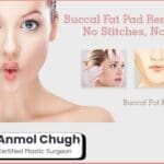Post-buccal fat removal care – swelling reduction and skin healing tips