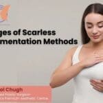 8 Advantages of Scarless Breast Augmentation Methods