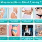 Tummy tuck surgery safety guide – patient preparing for a safe abdominoplasty procedure