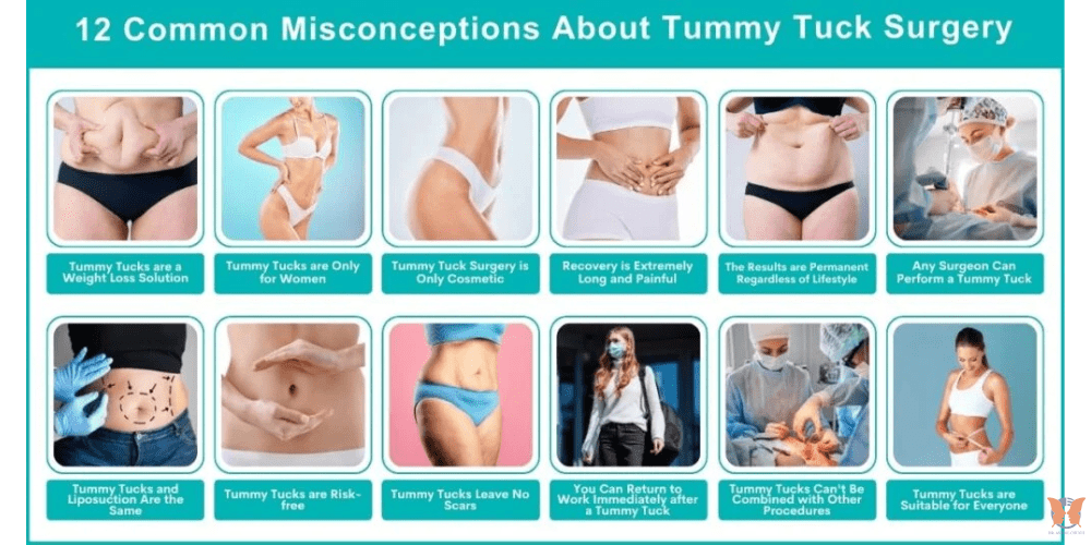 Tummy tuck surgery safety guide – patient preparing for a safe abdominoplasty procedure