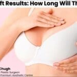 Breast Lift Results: How Long Will They Last?