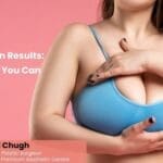 Breast Reduction Results: Health Benefits You Can Expect