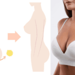 Natural breast fat transfer results – enhanced curves boosting dressing confidence and body image