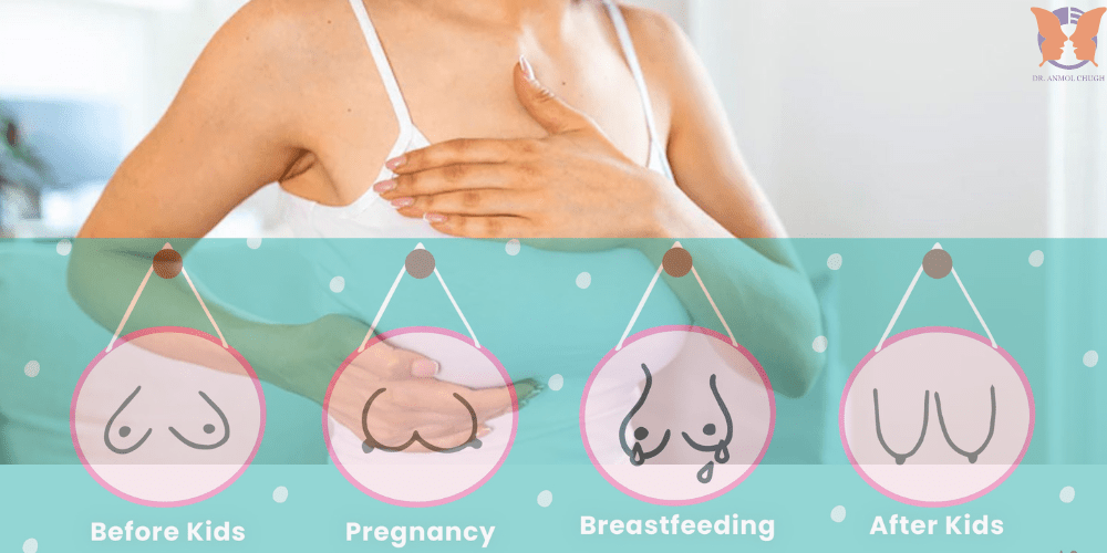 Post pregnancy breast care – natural ways to prevent breast sagging and maintain firmness