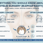 Everything You Should Know About Eyelid Surgery