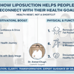 How Liposuction Helps People Reconnect with Their Health Goals