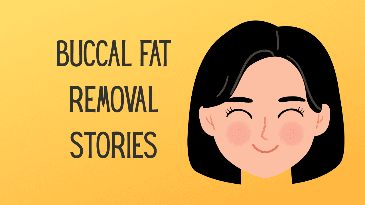 Buccal Fat Removal Testimonial – Happy Journey for the Patient