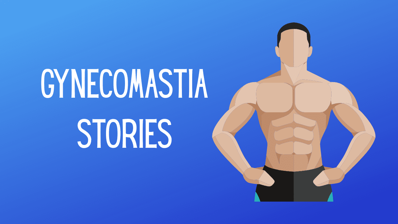 Happy Patient from IRELAND After Gynecomastia Surgery Journey in India