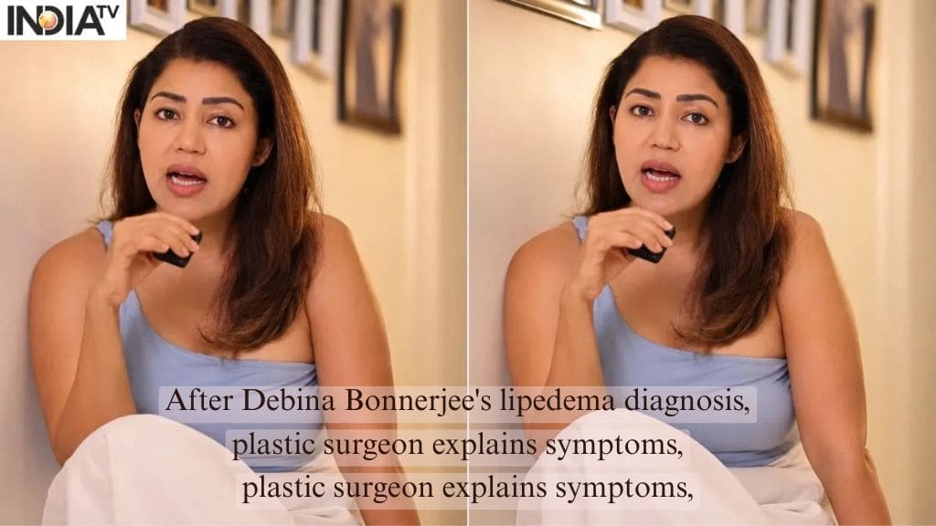 After Debina Bonnerjee's lipedema diagnosis, plastic surgeon explains symptoms, causes and treatment